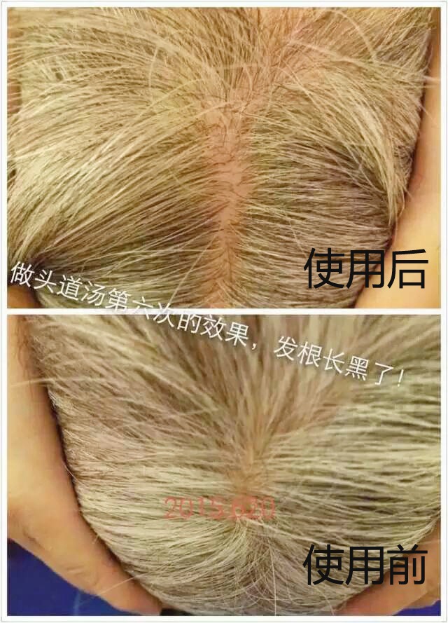 头道汤头皮清净液使用效果